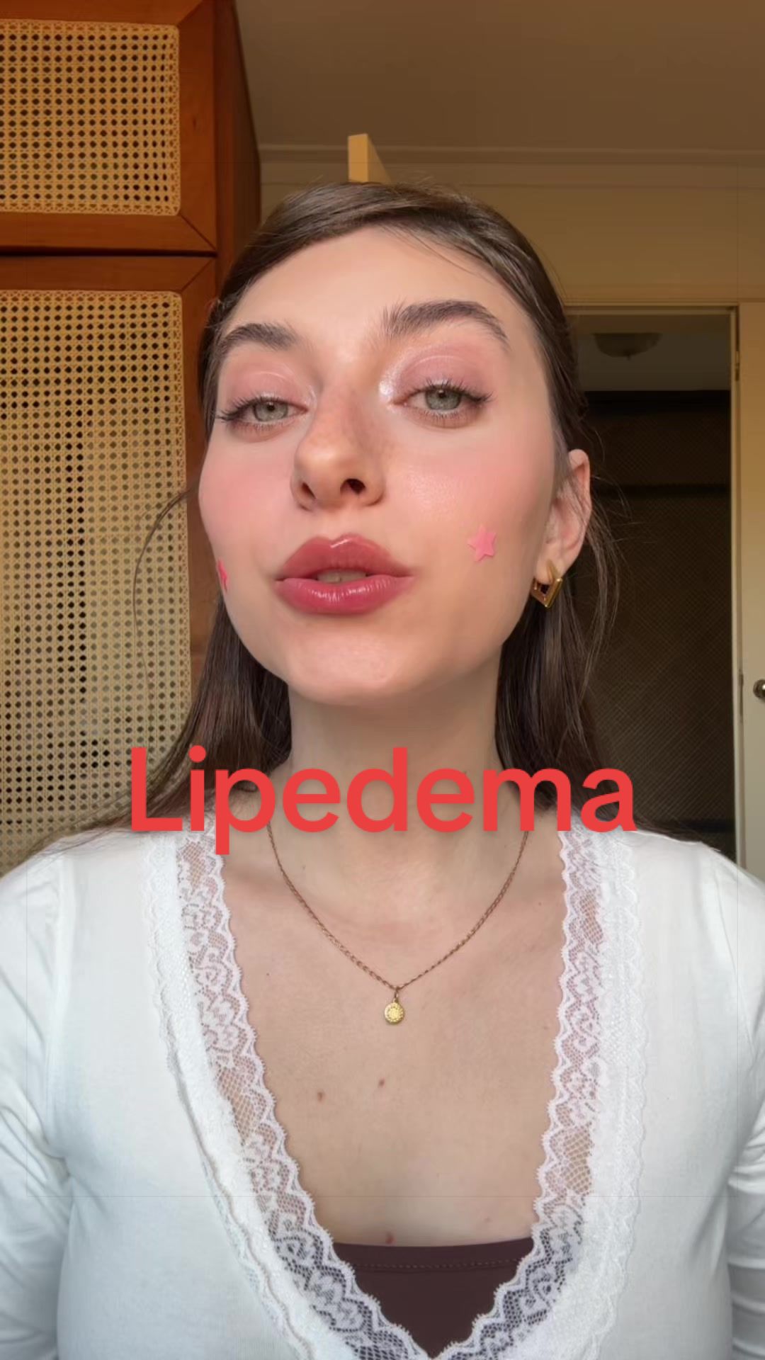 @SOGARICO
