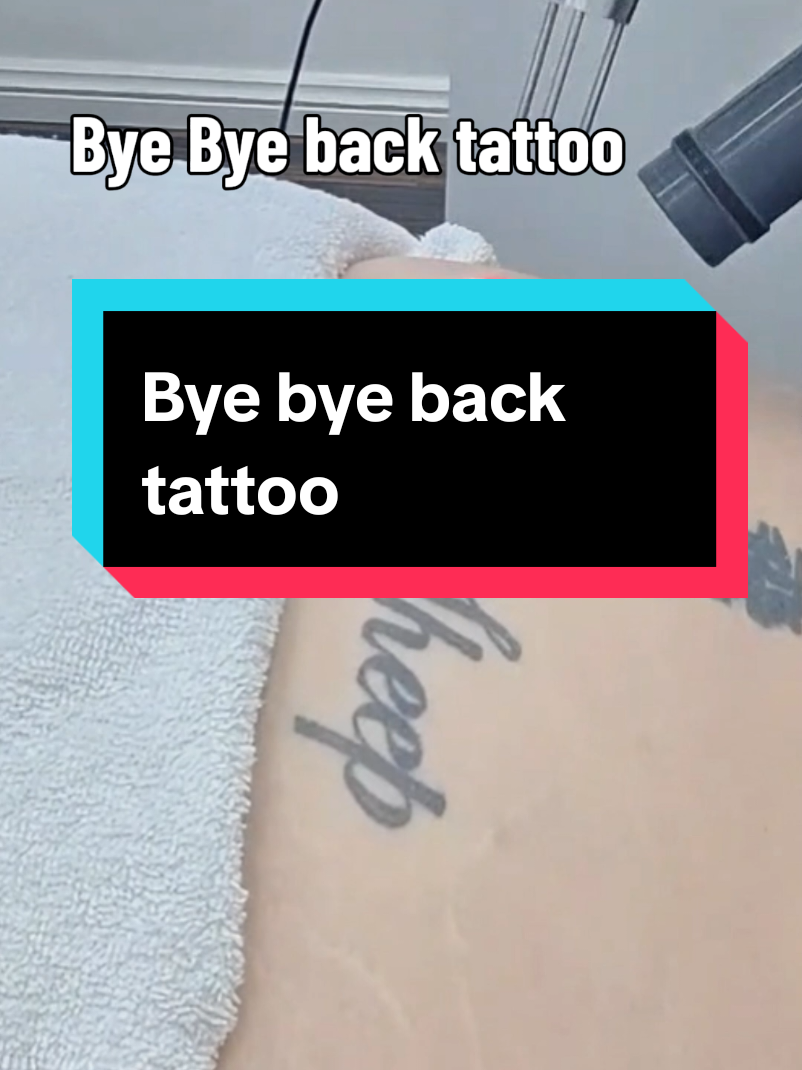 @Jamie T| Tattoo Removal Expert