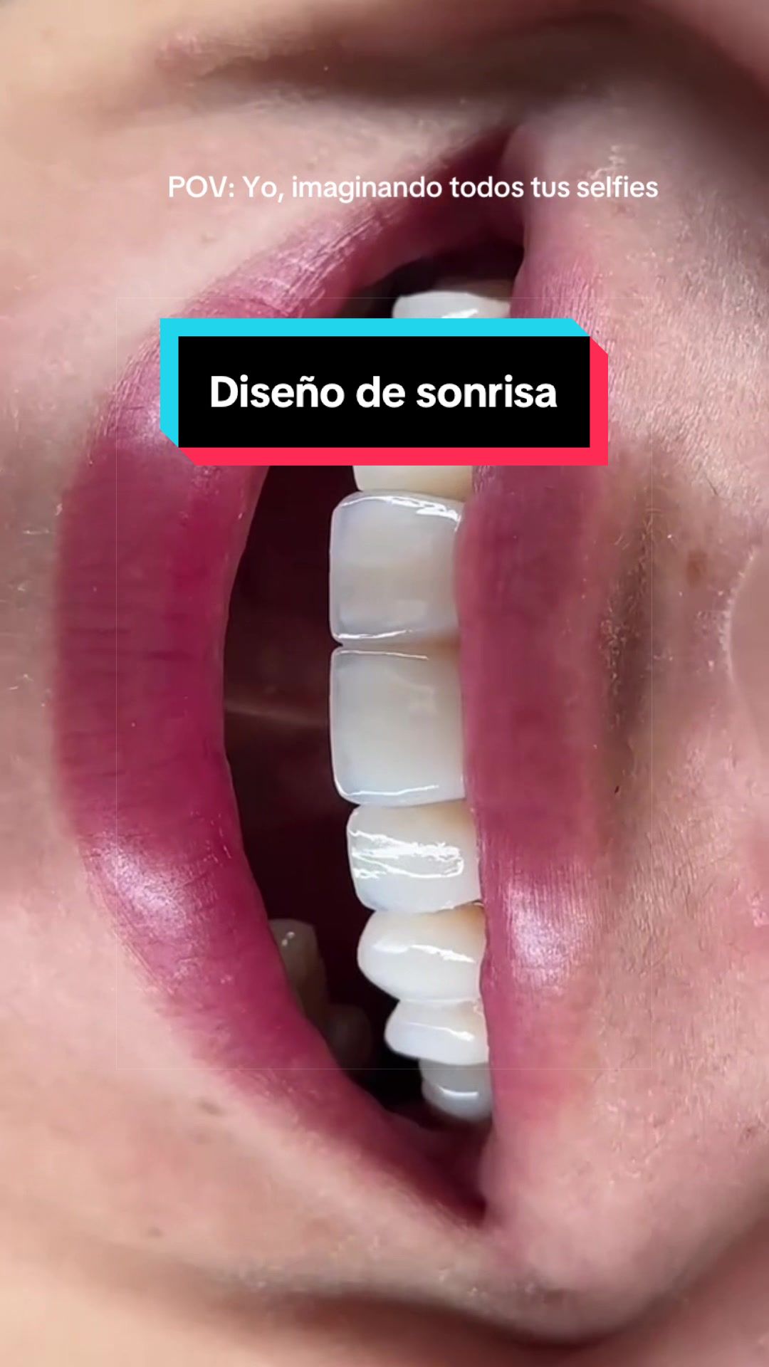 @Dr Carillas