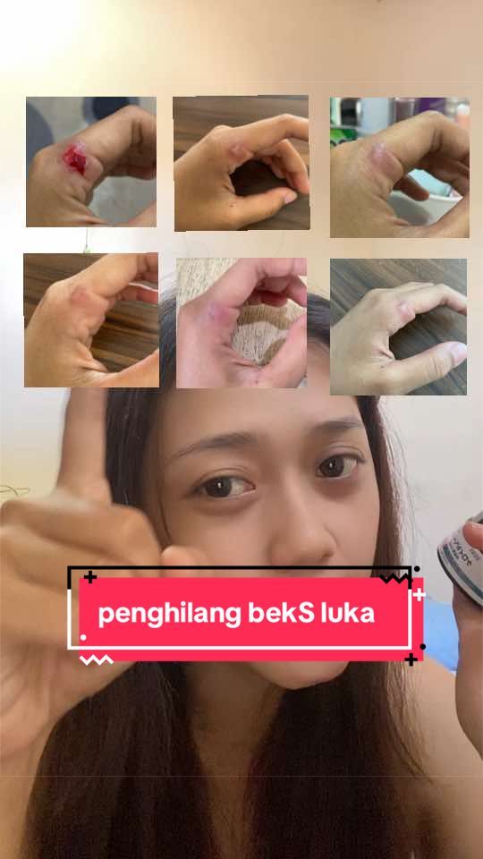 @GriiizpiiL