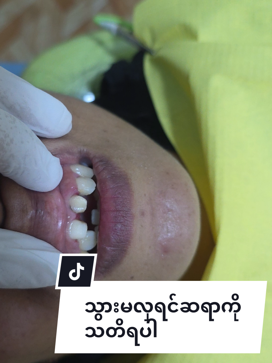 @Dr.KoKoSawMin(သွားဆရာဝန်)