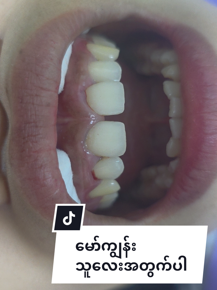 @Dr.KoKoSawMin(သွားဆရာဝန်)