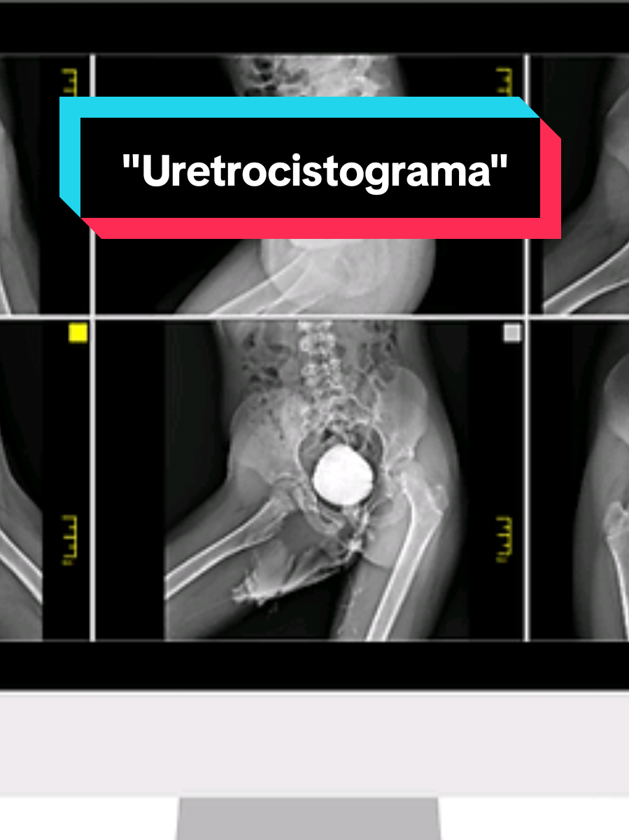 @Dr. Irwing Nefr&oacute;logo-Pediatra