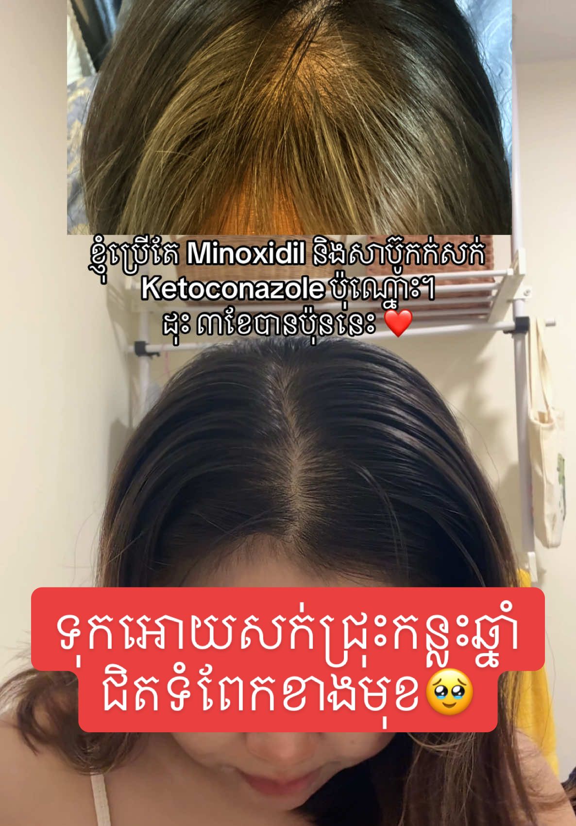 @Malis_ម៉ាលិះ