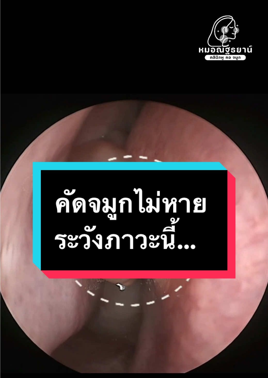 @คลินิกหมอณัฐธยาน์ หู คอ จมูก