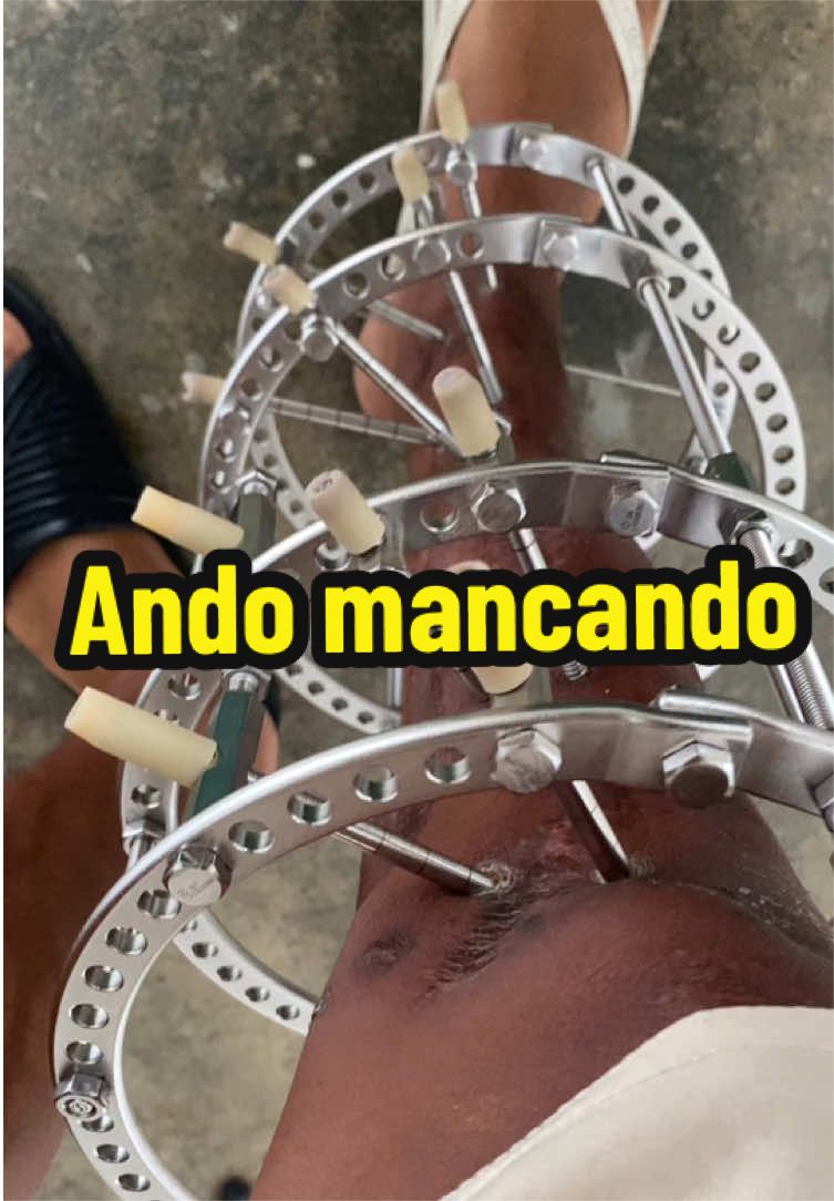 @Halef Henrique