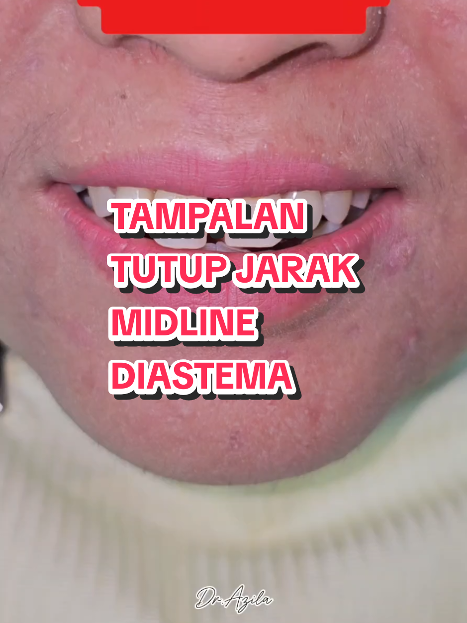 @Dr. Azila