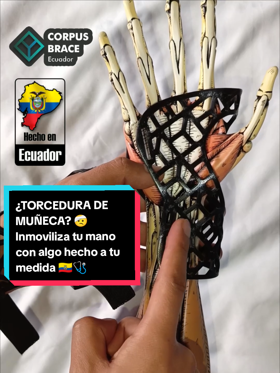 @Corpus Brace