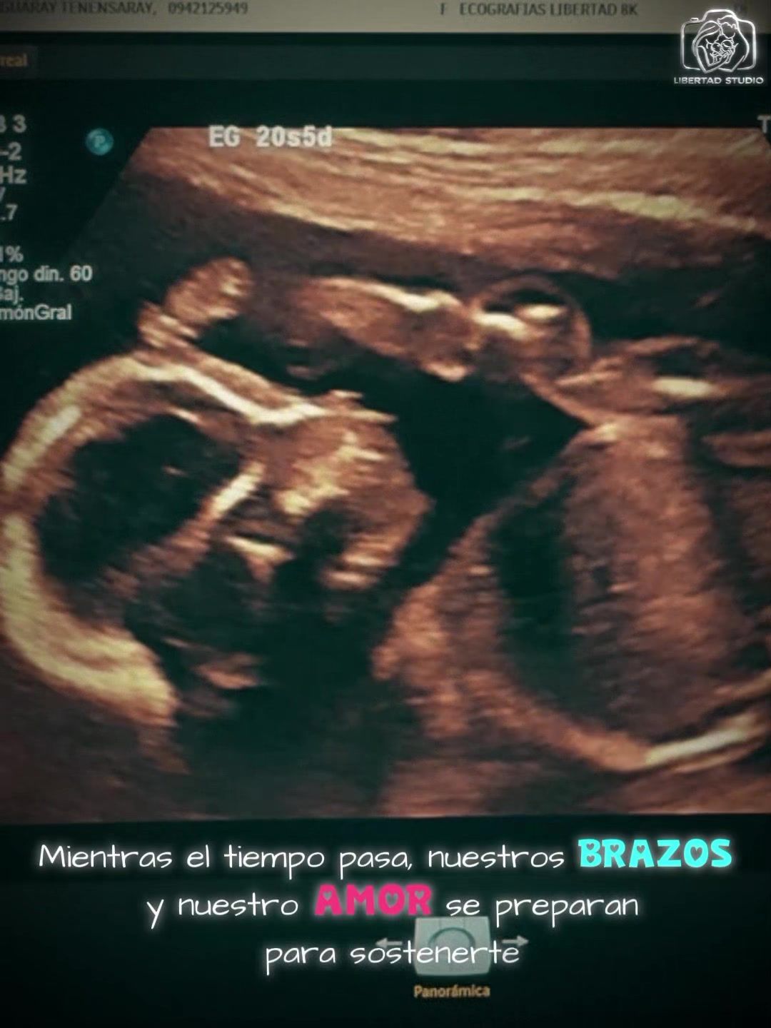 @ECOGRAFIAS LIBERTAD 8K