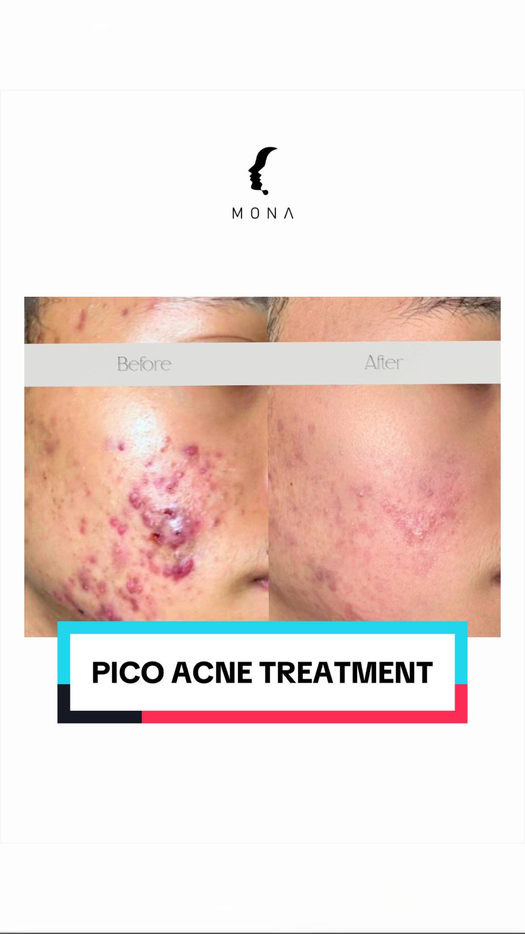 @MONA SKIN LASER & BEAUTY