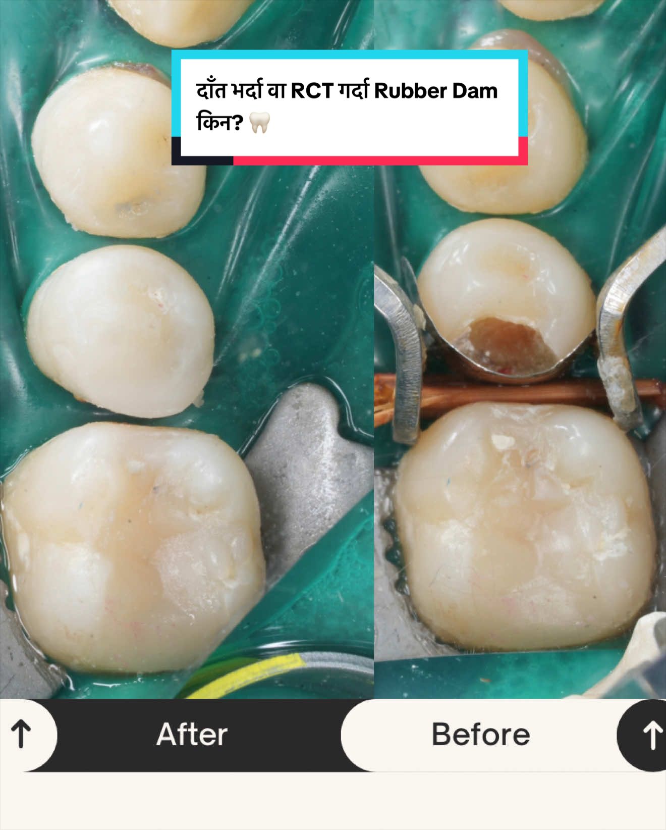 @Smile Engineer Dr Bidhan