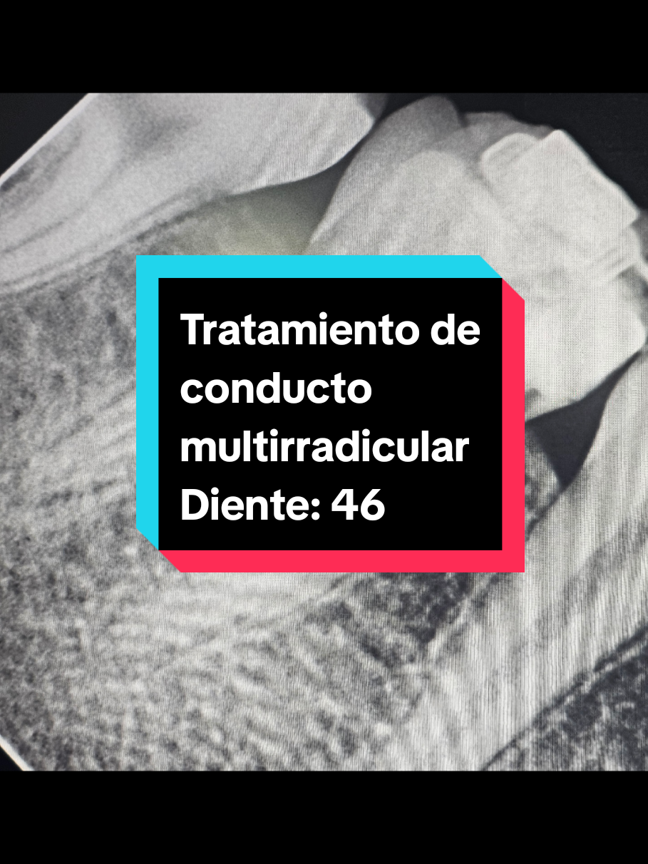 @Norman Rizk |ENDODONCISTA|