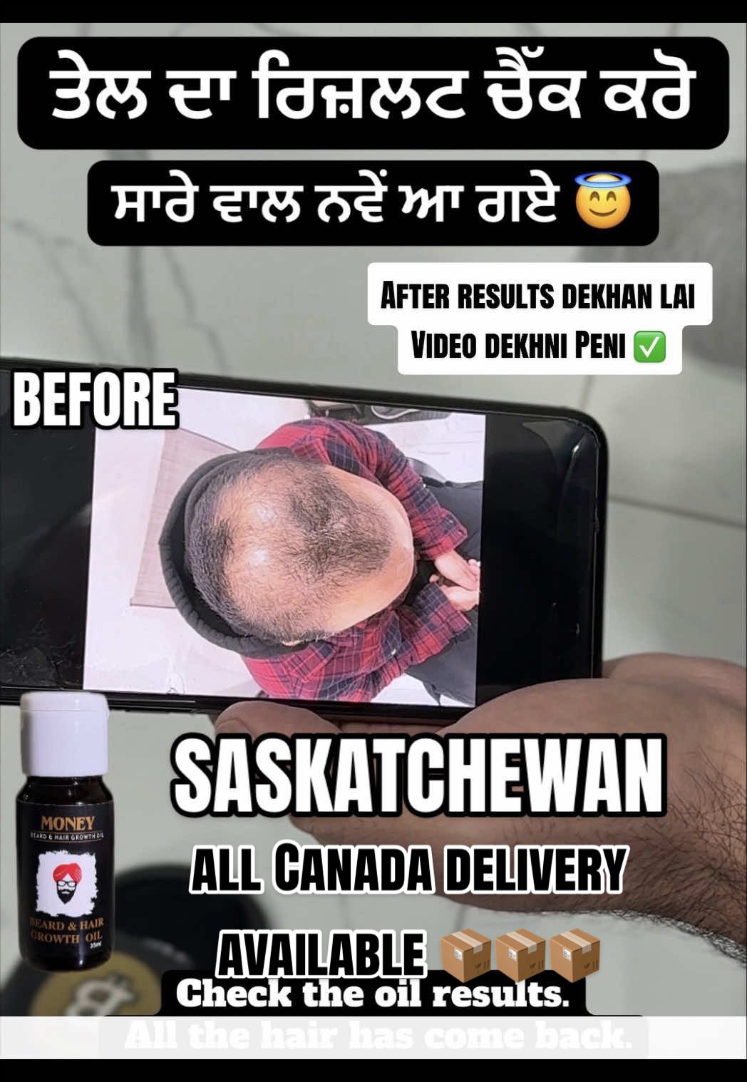 @money_beard_growthoil