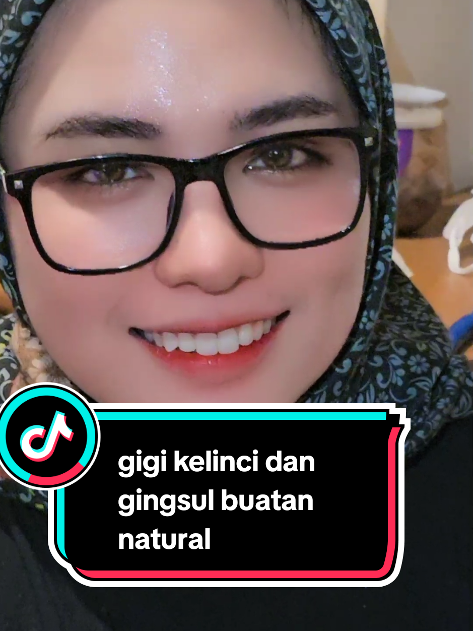 @fiqy gigi