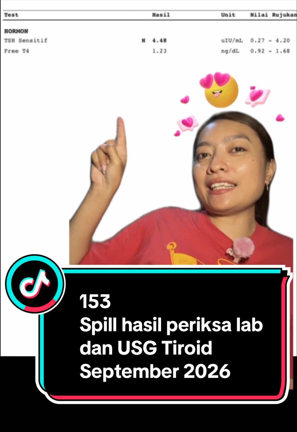@Fionalois Pertiwi