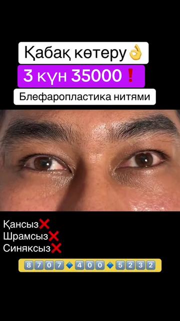 @Стоматология, Блефаро, ПМ 🇰🇿