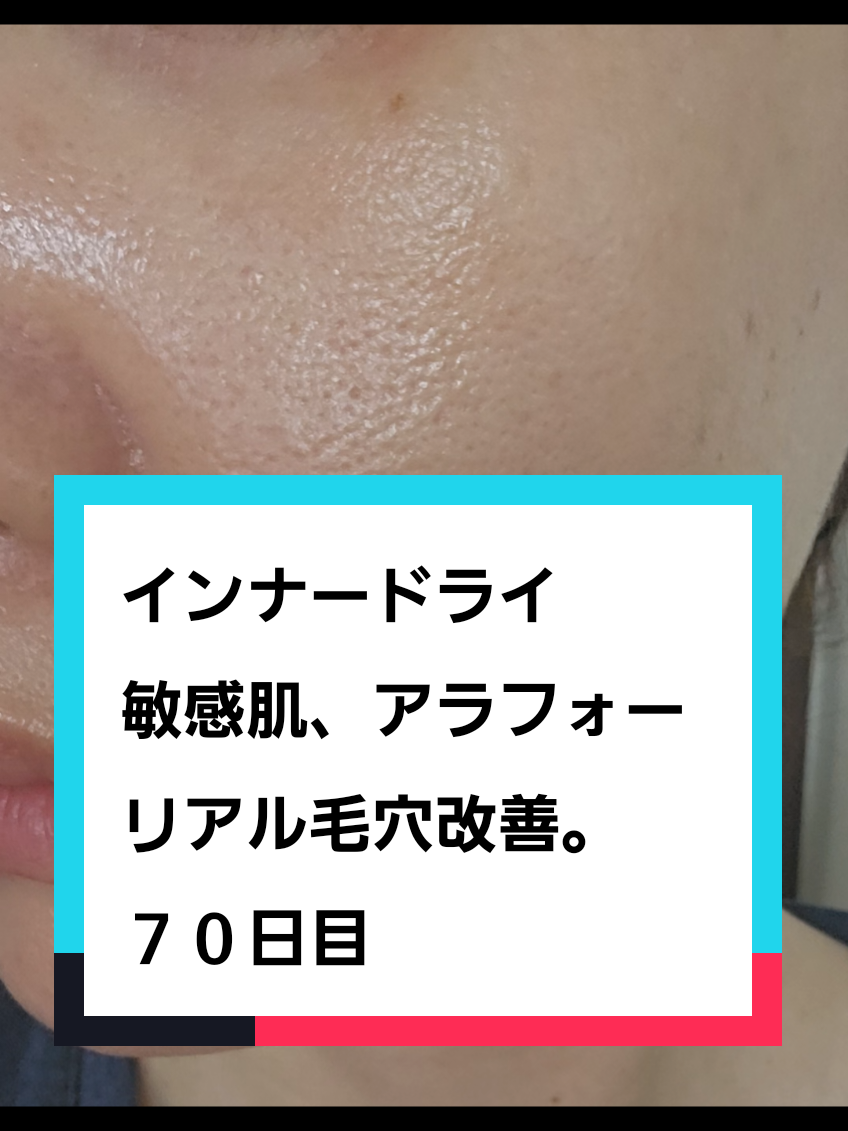 @リアル毛穴改善記録