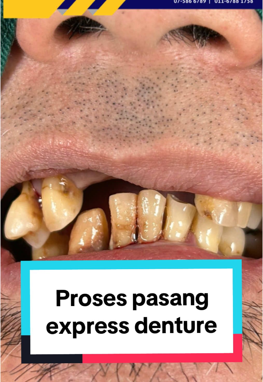 @Ikhsan & Sons Dental 🦷