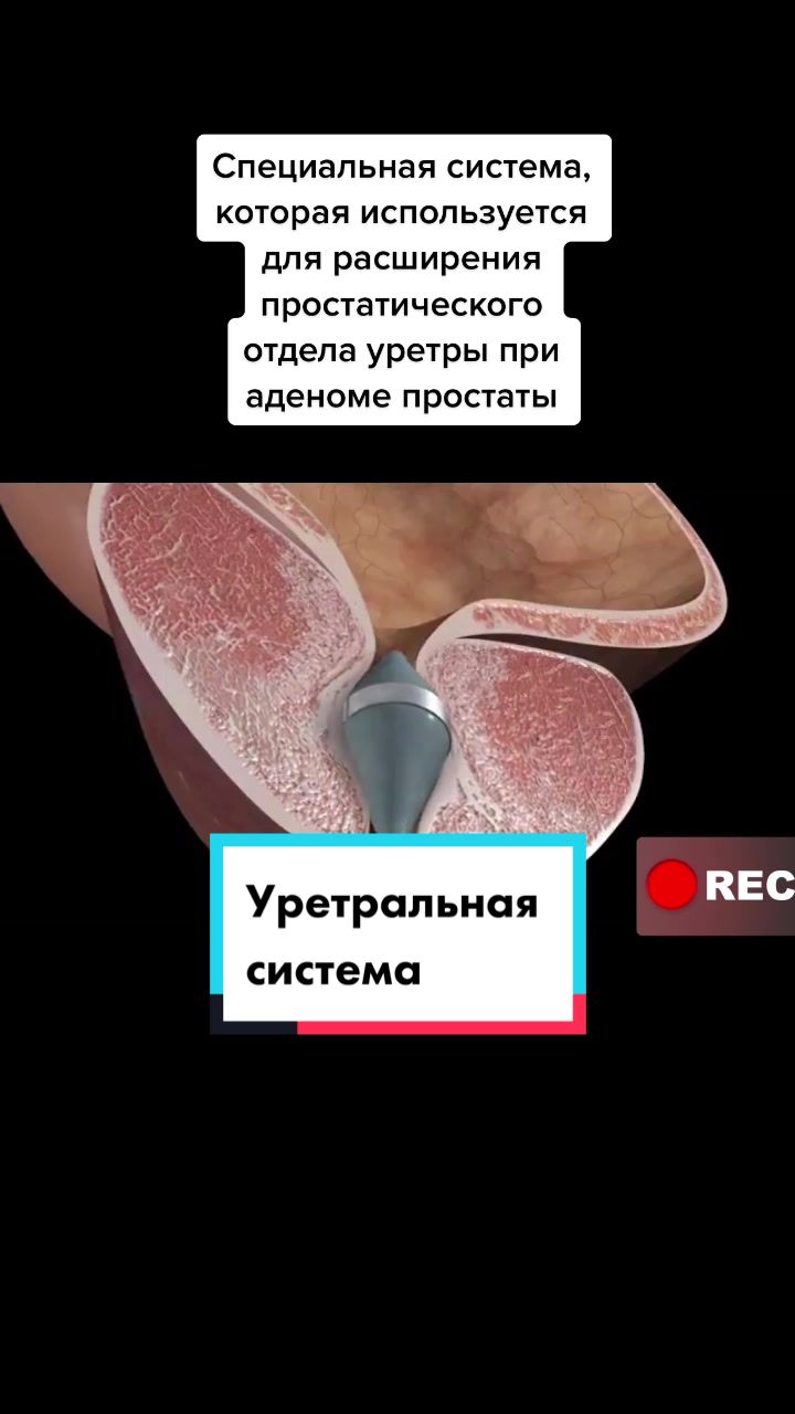 @Denis Davydov