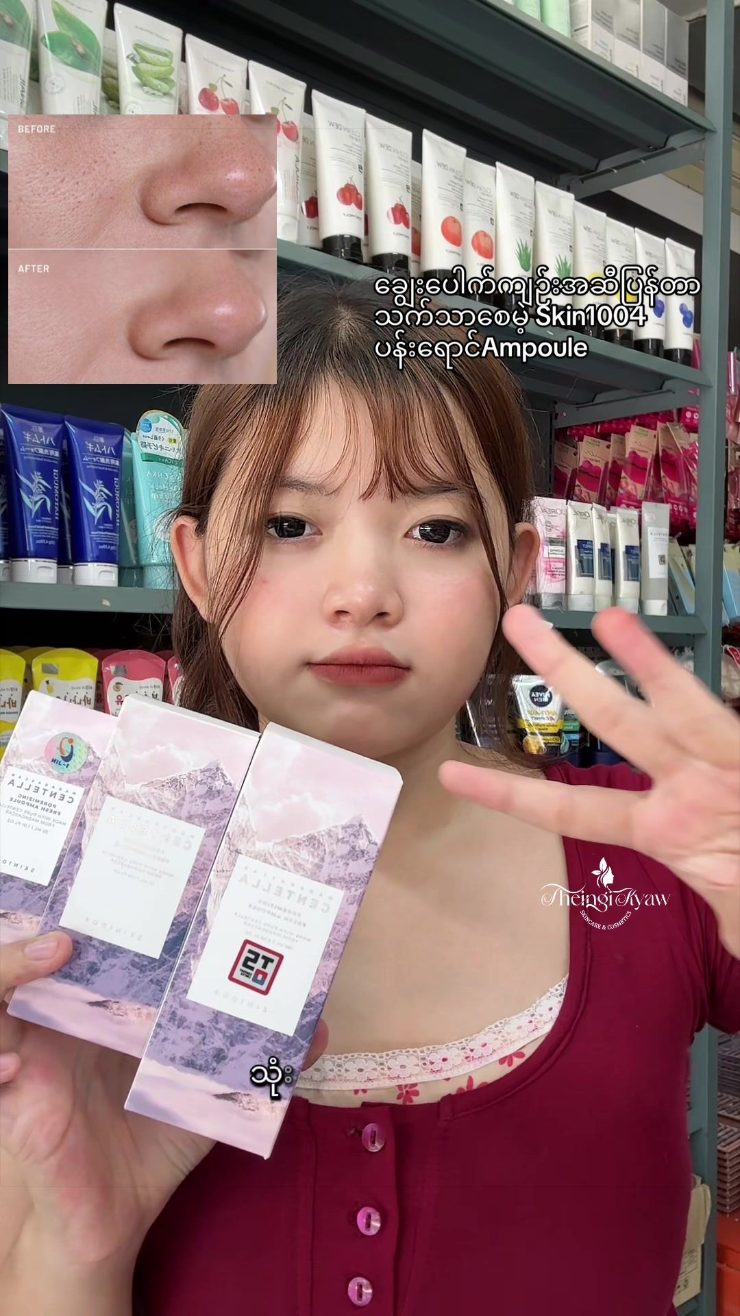 @FB: TheingiKyawSkincareShop