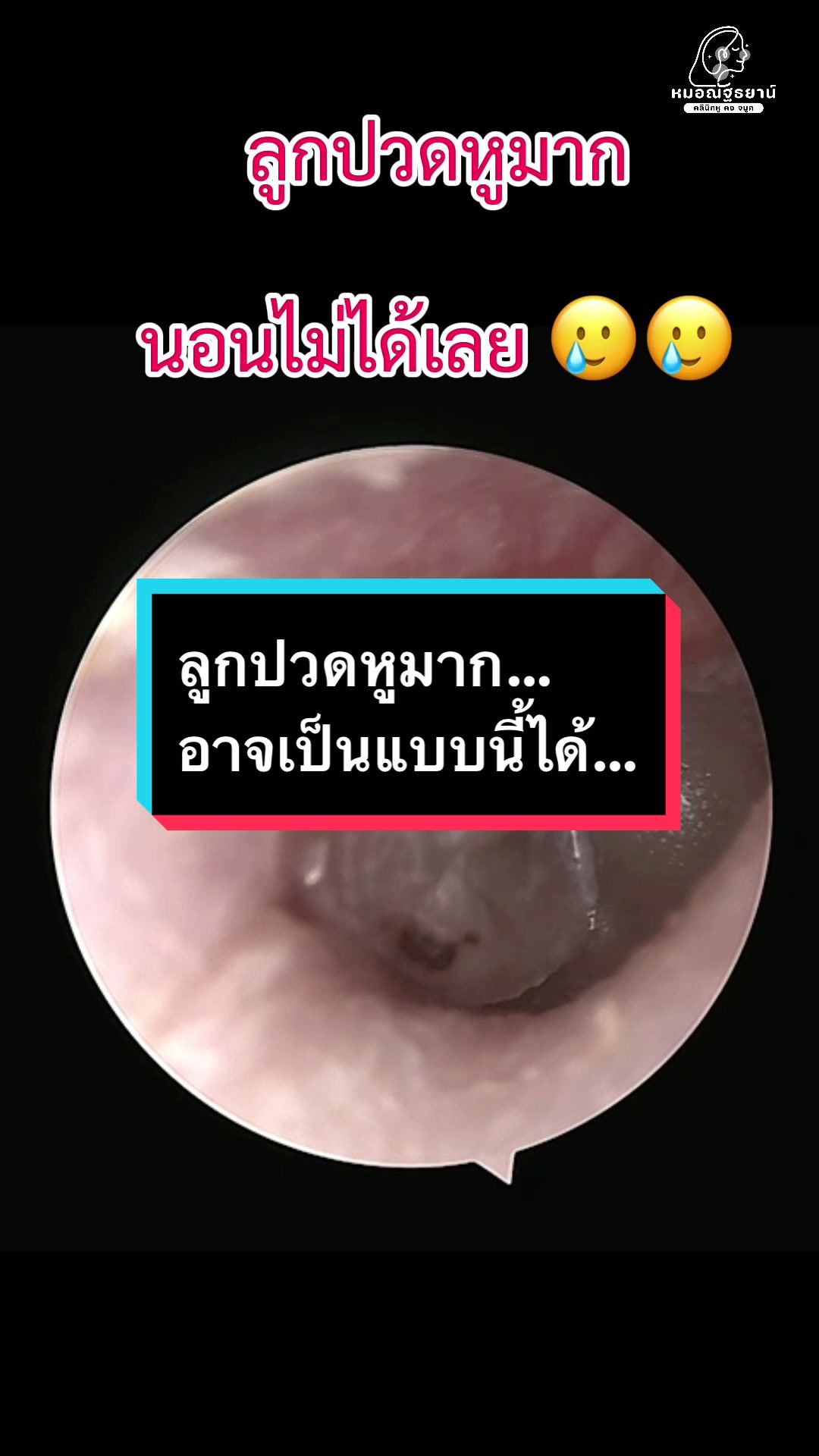 @คลินิกหมอณัฐธยาน์ หู คอ จมูก