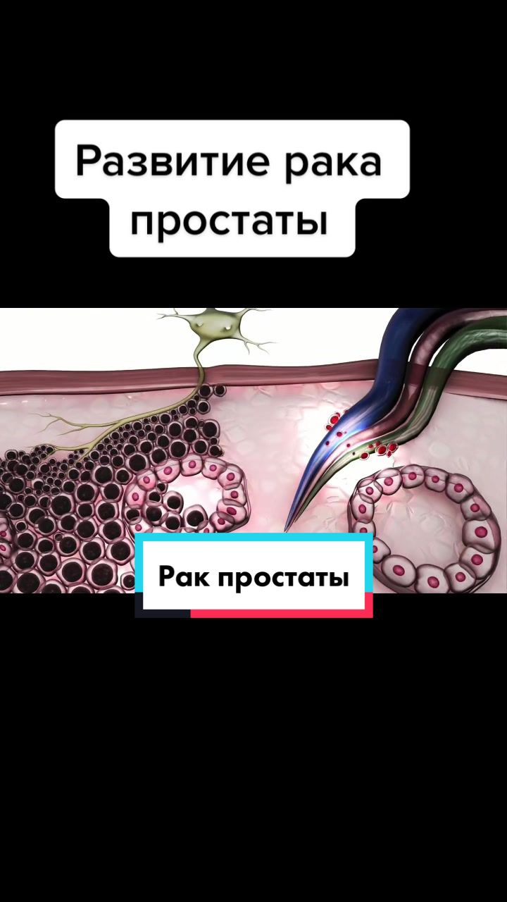 @Denis Davydov