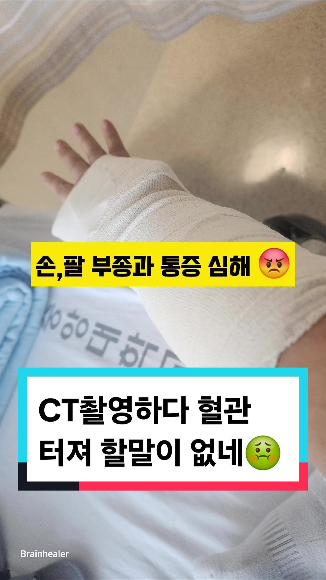 @브레인힐러