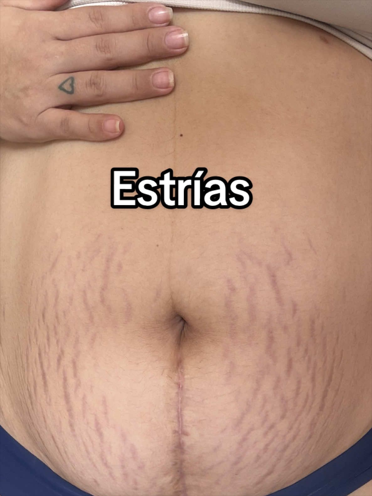 @Maria Rene Mundaca Hinojosa