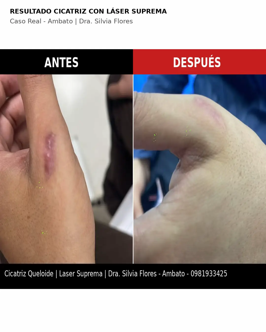 @Dra Silvia Lorena FLORES derma