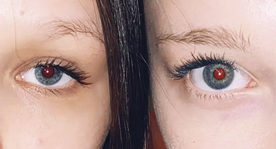 @Алиска