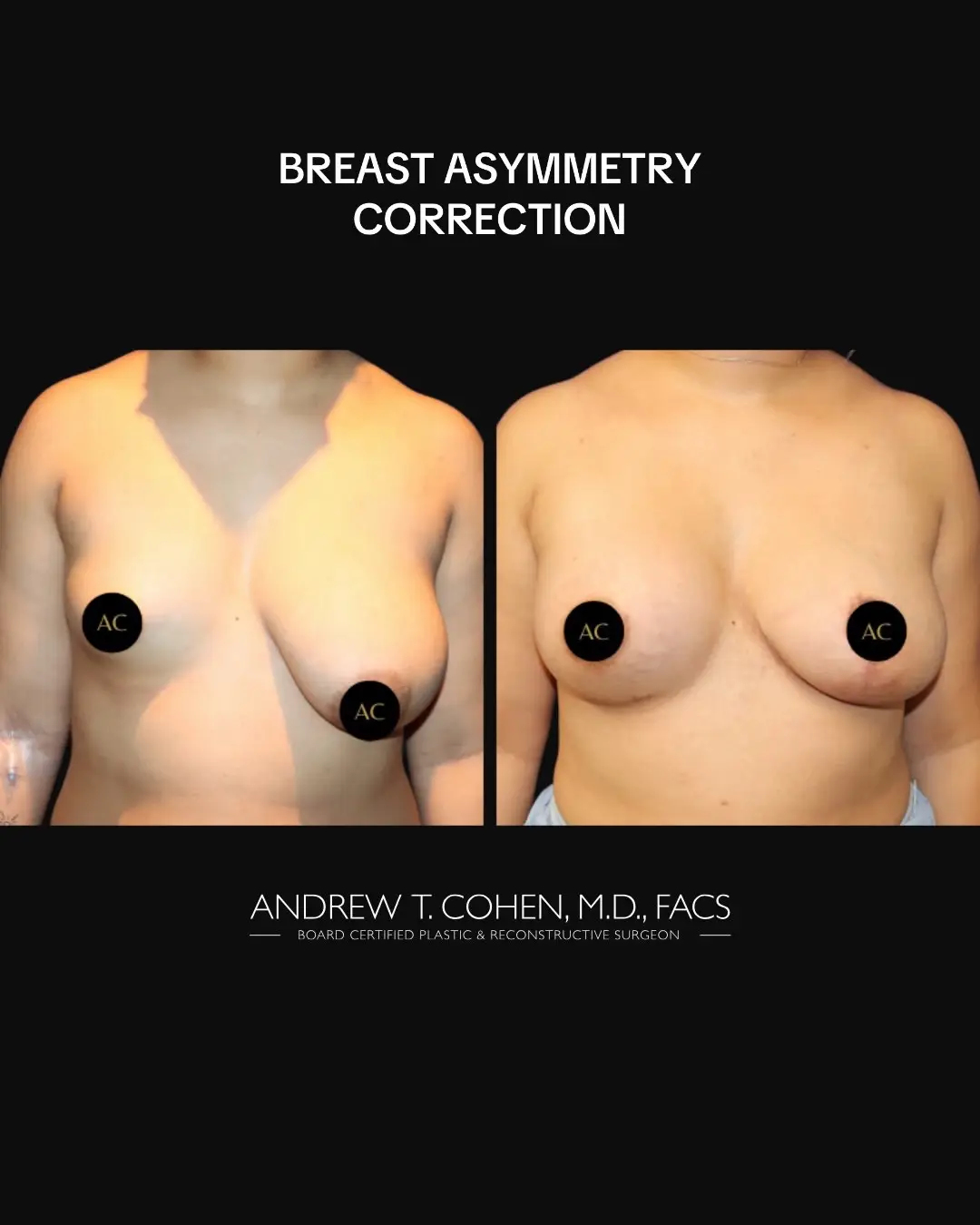 @Cohen MD Plastic Surgery