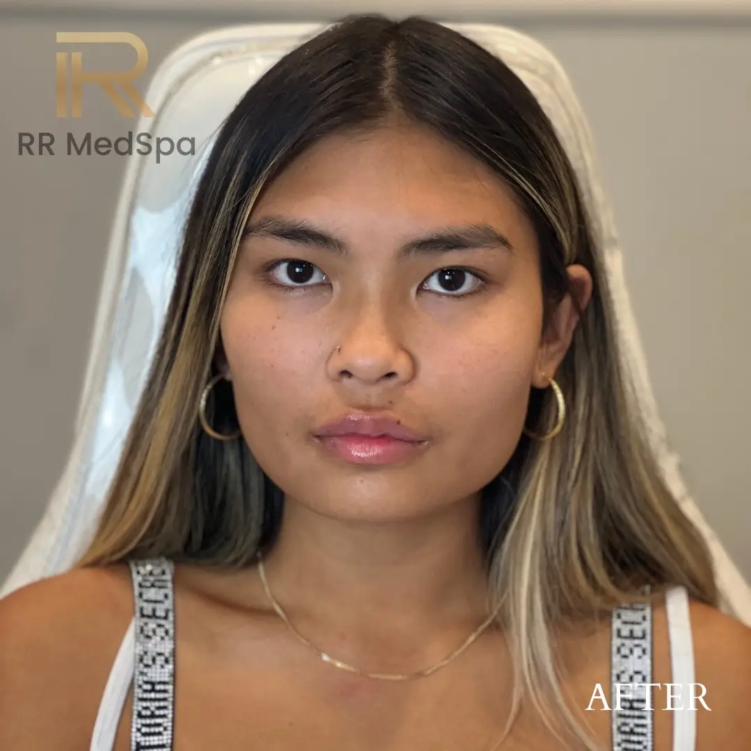@RR Medspa