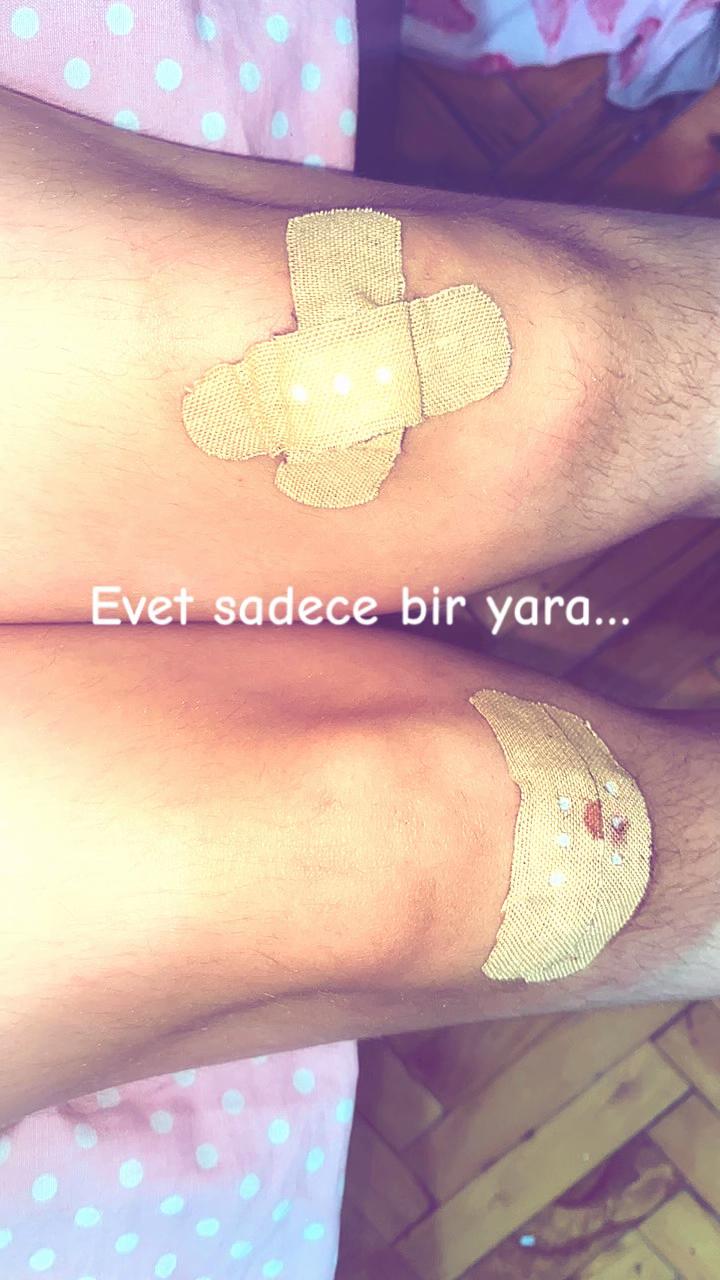 @Hilal yelekçi