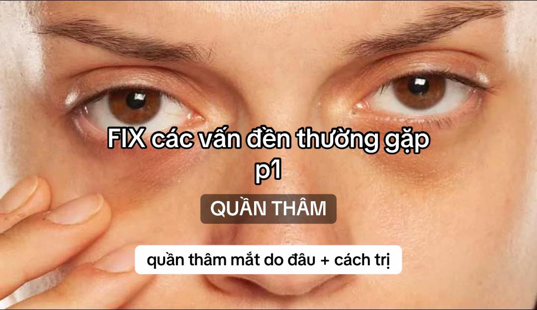 @Trippy
