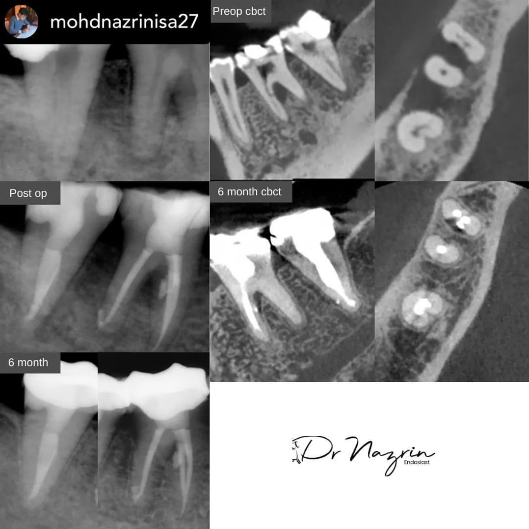 @Klinik Pergigian Erfa