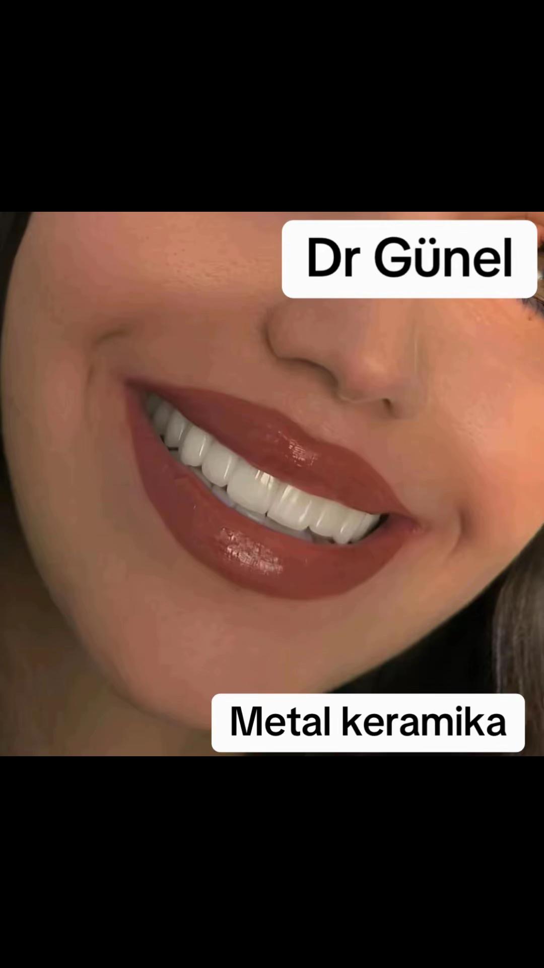 @Dentist_Günel