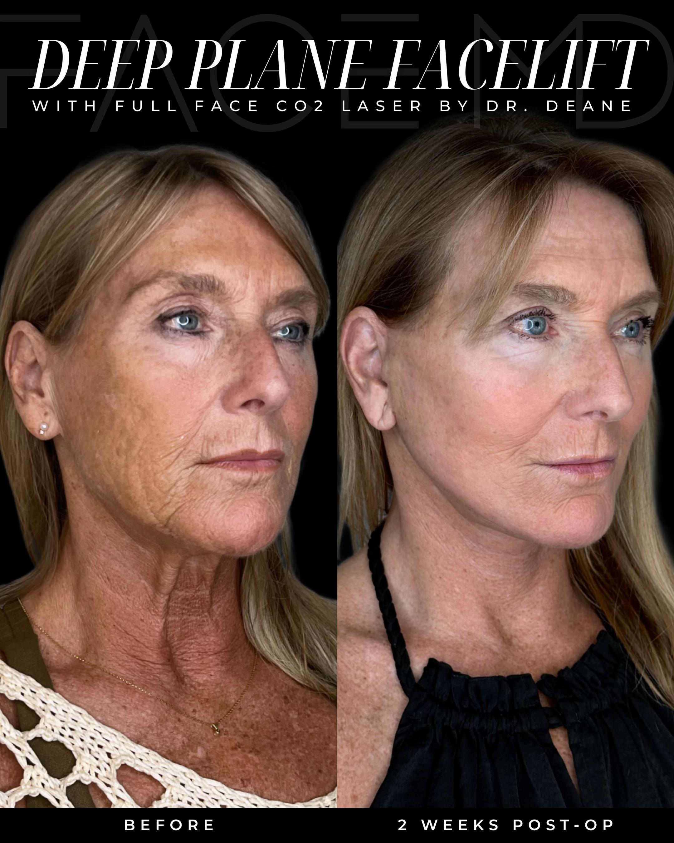 @cliniquefacemd