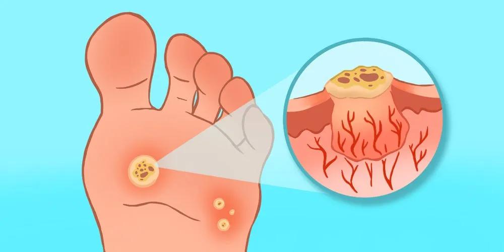 @Home Podiatry