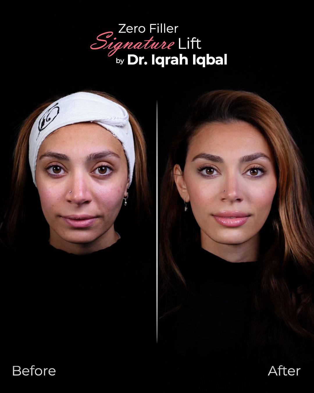 @Dr.Iqrah.Aesthetics