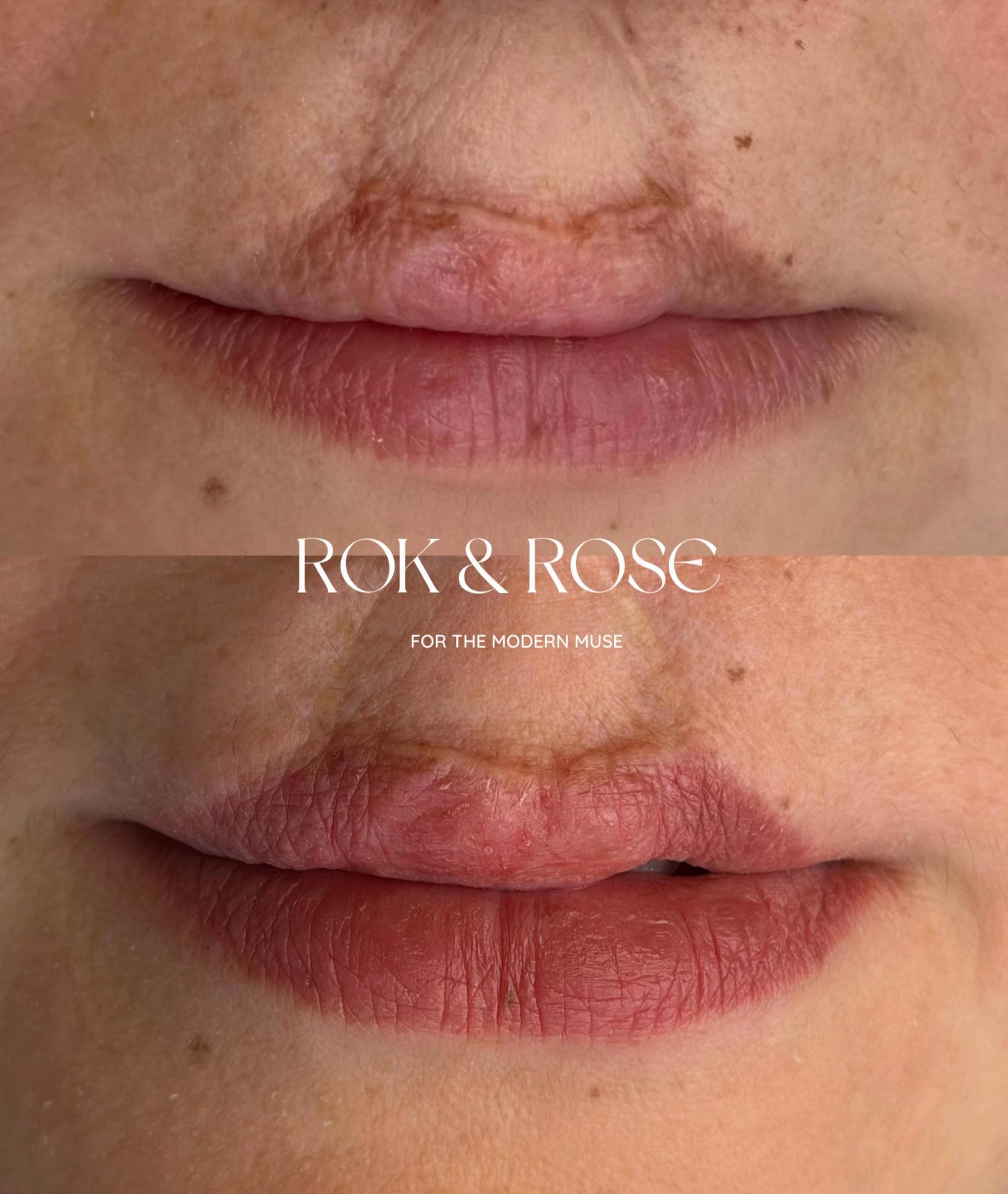 @Rebecca Teasdale | Lip Blush