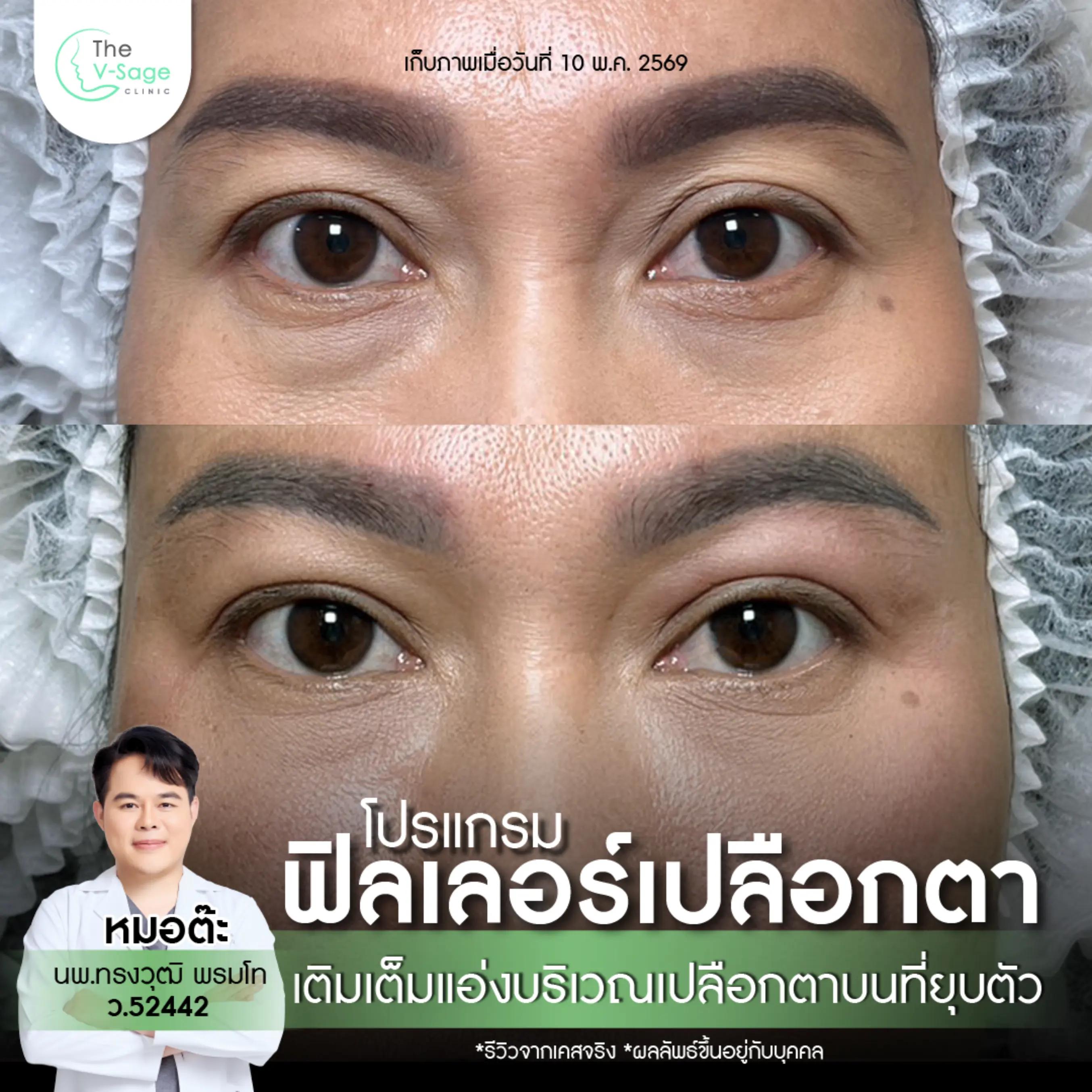 @หมอต๊ะ The V-Sage Clinic