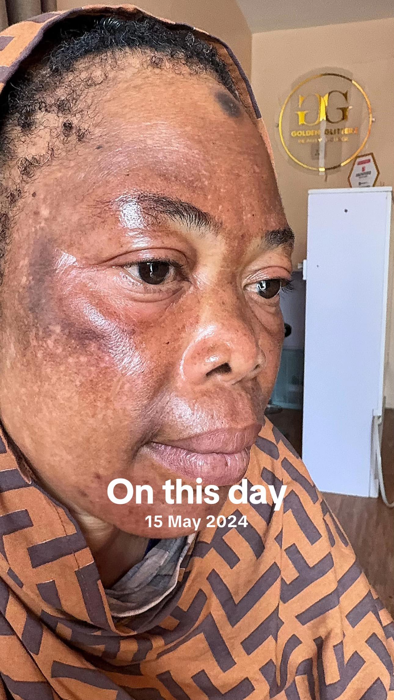 @FIX SKIN NIGERIA