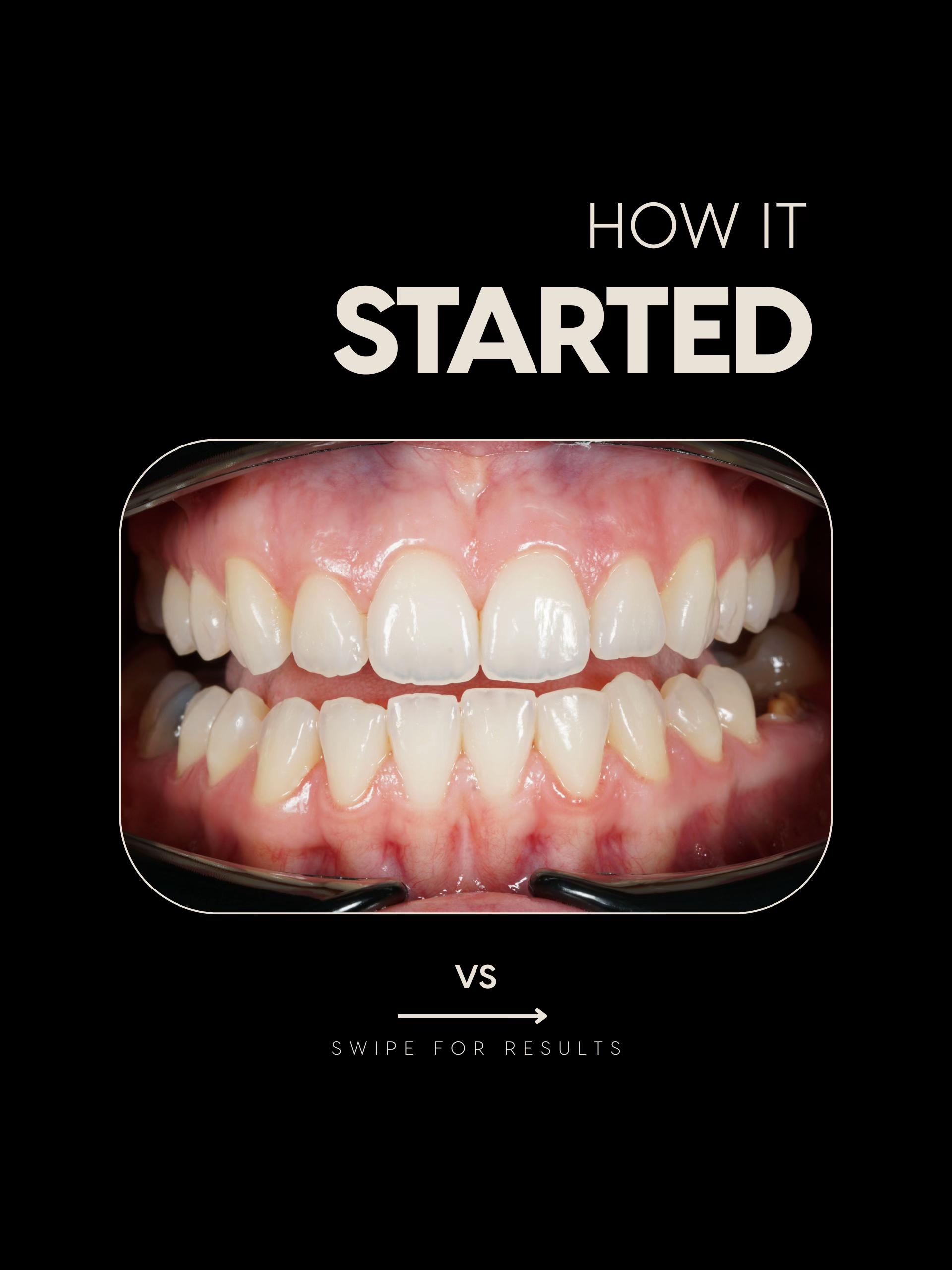 @Dentalexcellenceuk