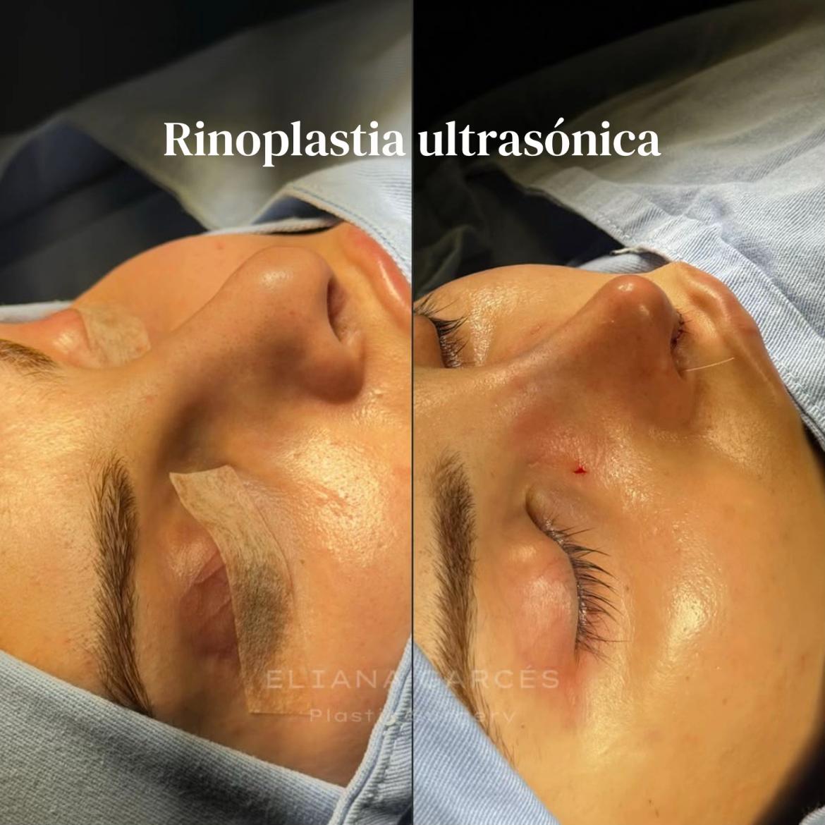 @Eliana Garc&eacute;s Plastic Surgery