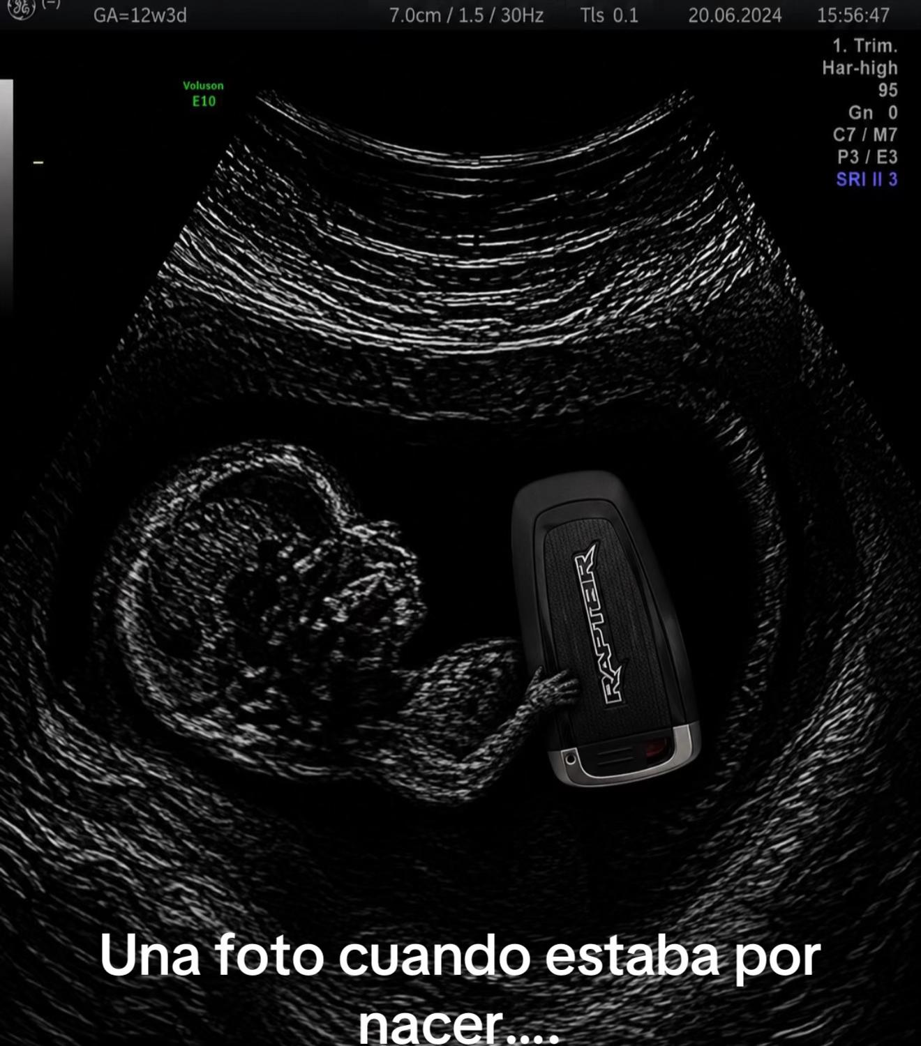 @Luis Menjivar