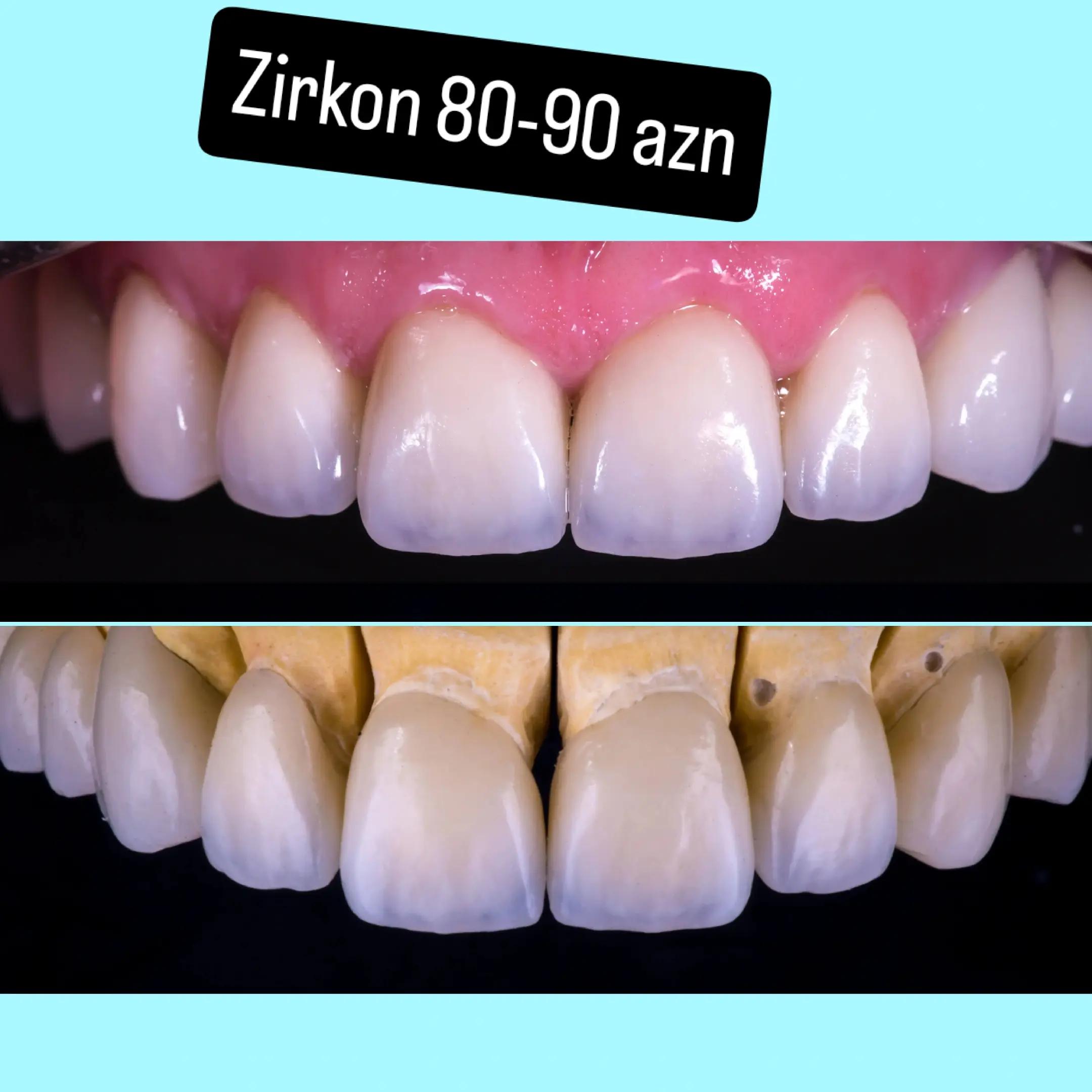 @implant.32