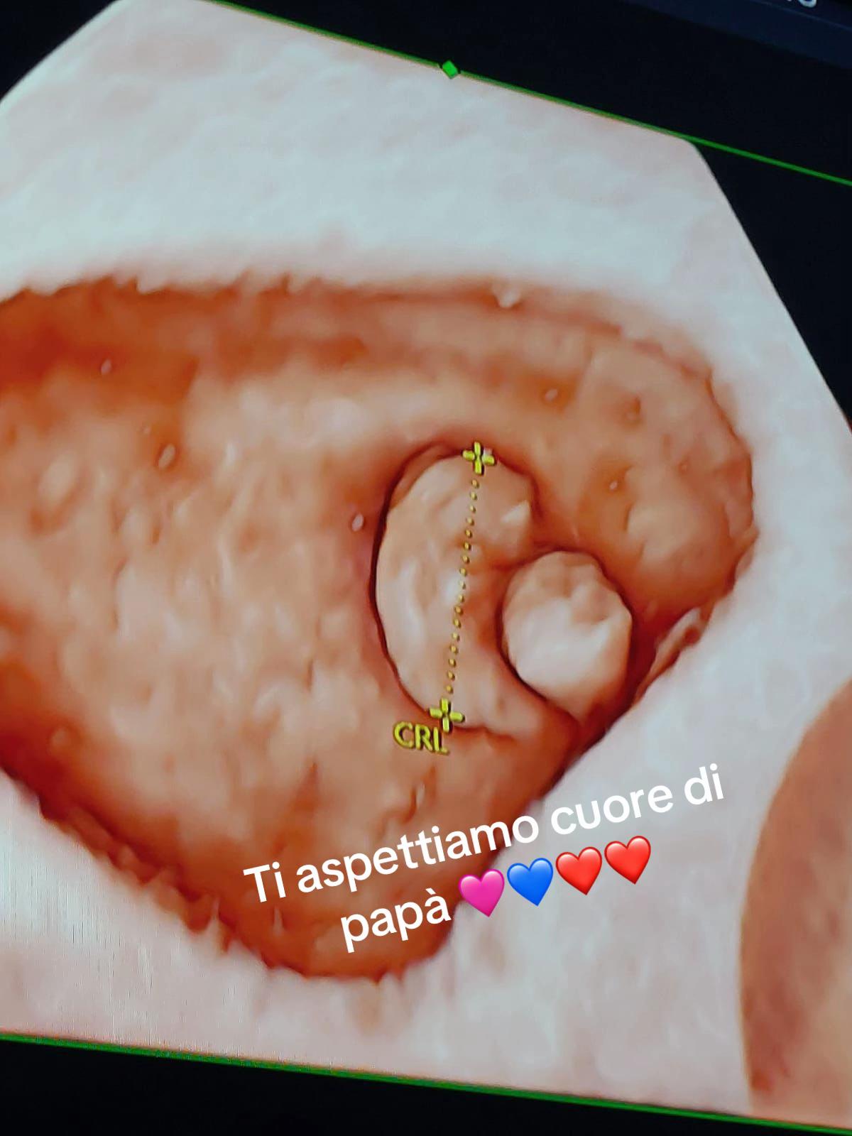 @Antonino Bisiccè