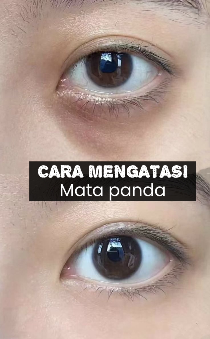 @Cantik Glow