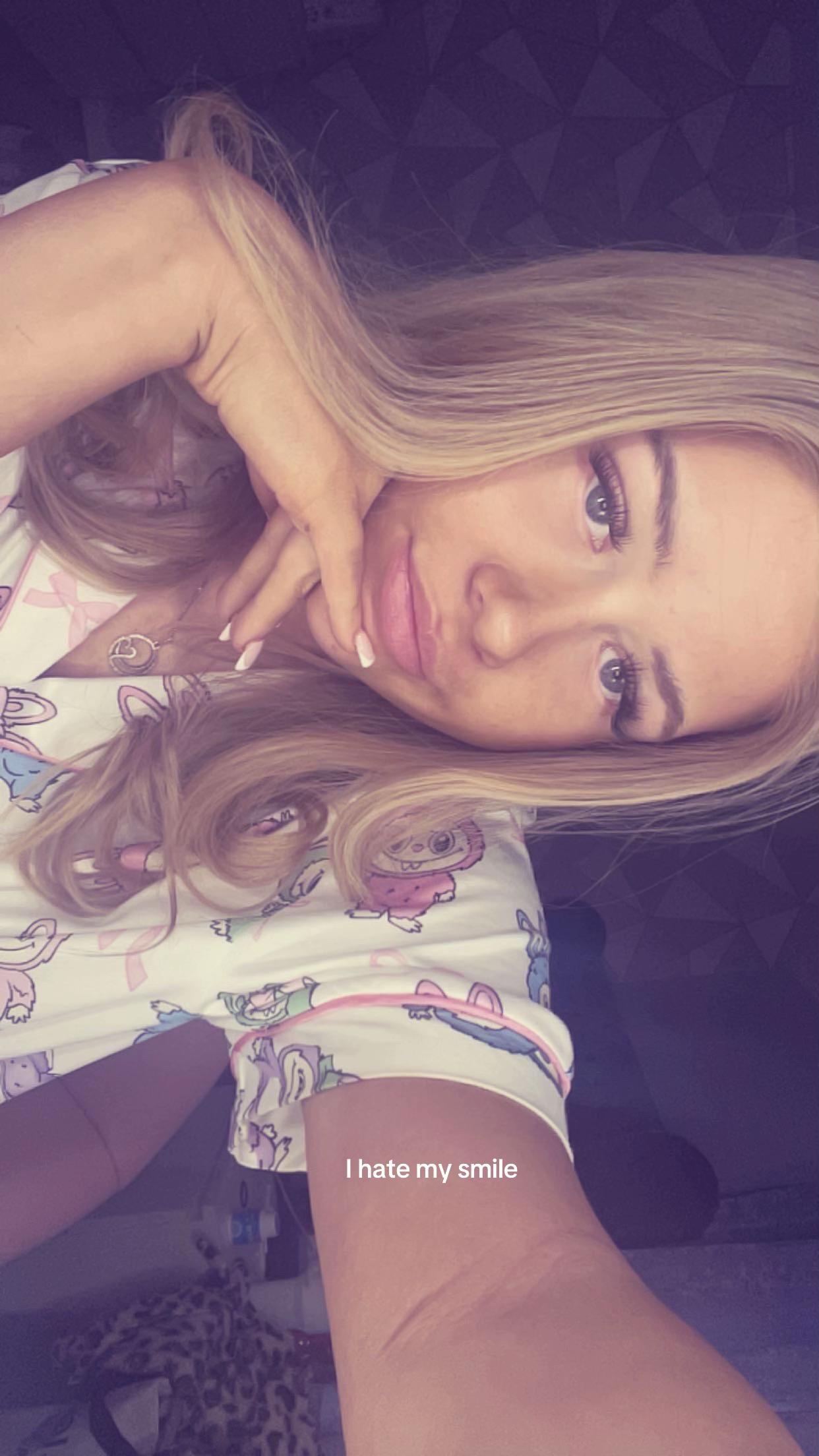 @xo.chlo.0