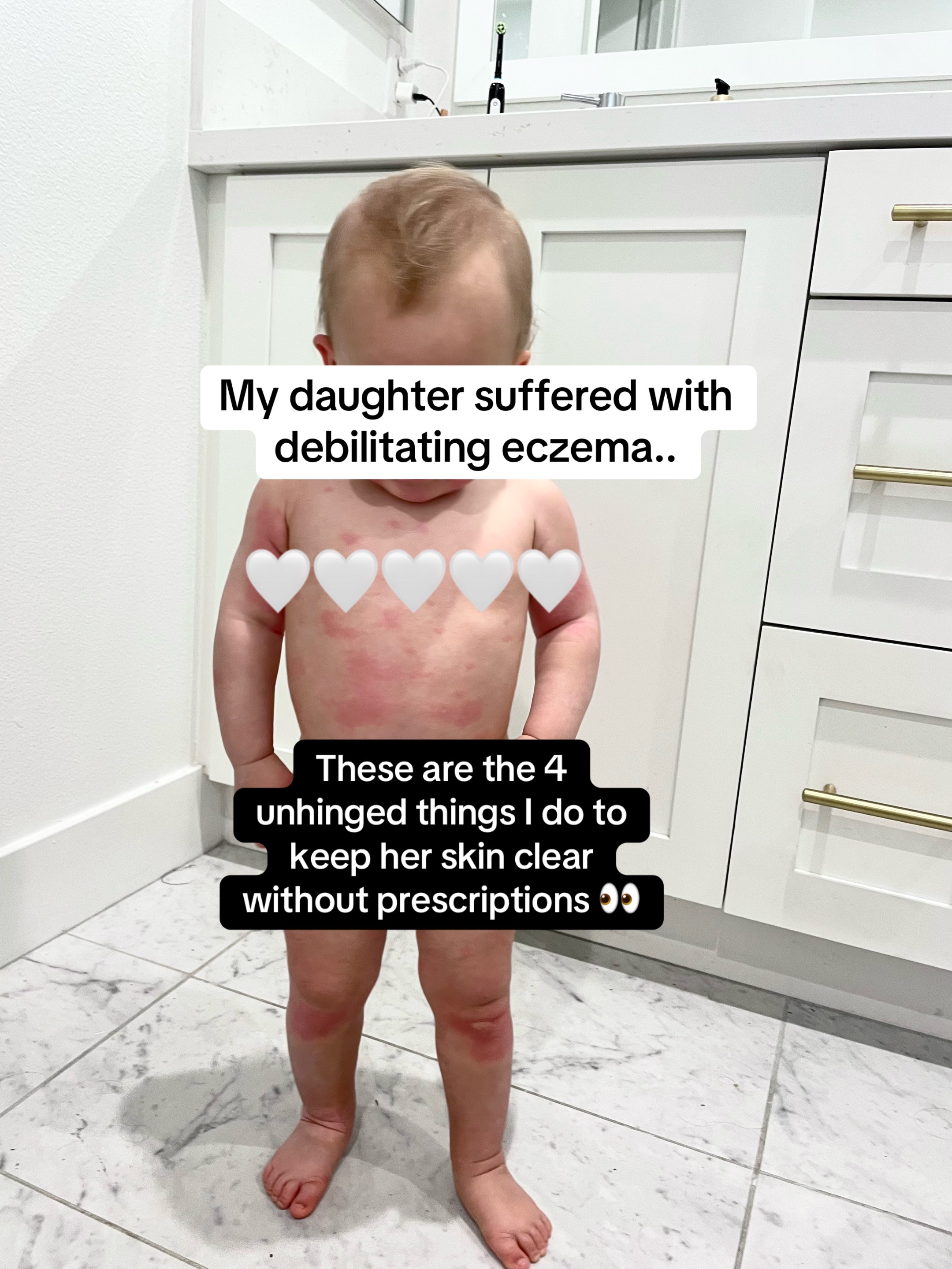 @Celeste | RN acne expert